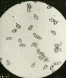 Inocybe rimosa image