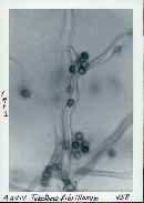 Tulostoma fibrillosum image