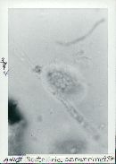 Media resource of Scutellinia asperrima