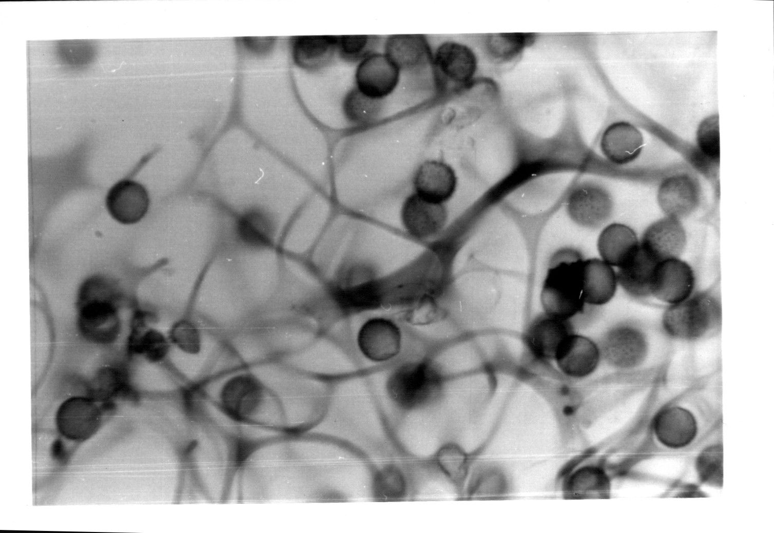 Leptoderma