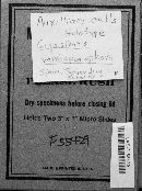 Image Associated With the Occurrence