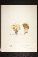 Media resource of Scleroderma reae