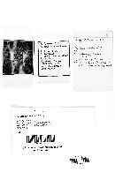 Arcyria cinerea (d3) image