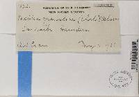 Trapeliopsis granulosa image