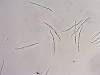 Spathularia velutipes image