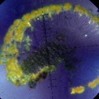 Candelariella antennaria image