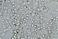 Helicogloea compressa image