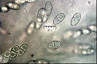 Nectria peziza image