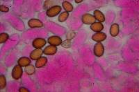 Psilocybe samuiensis image