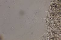 Lachnum abnormis image