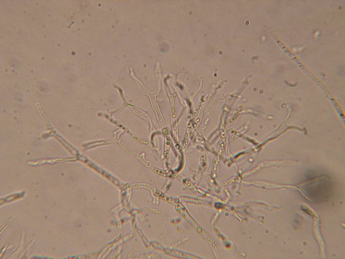 Dacrymyces minor image