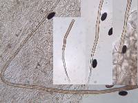 Parasola conopilea image