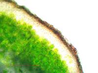 Acarospora americana image