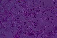 Helicogloea compressa image