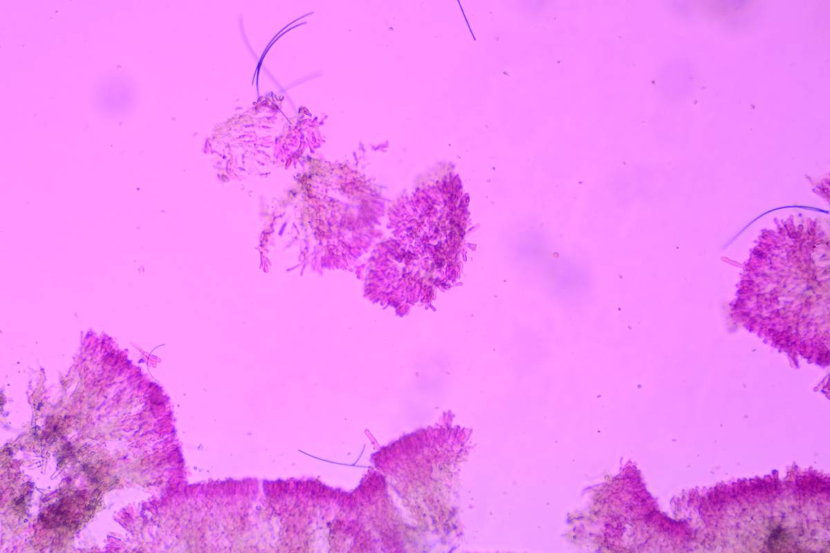 Phanerodontia magnoliae image