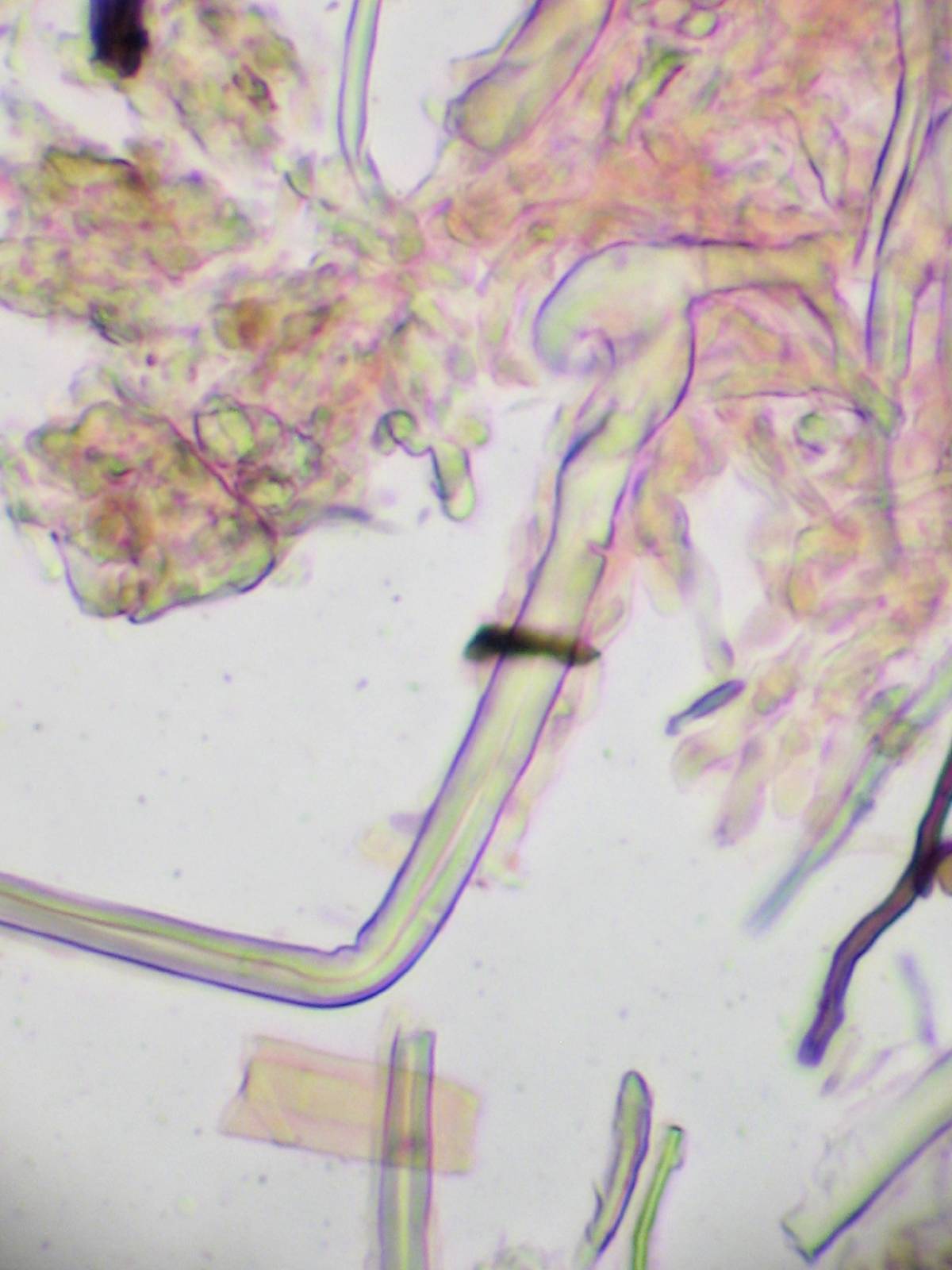 Tubulicrinis chaetophorus image