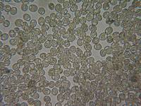 Pluteus brunneidiscus image