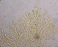 Amanita magniverrucata image