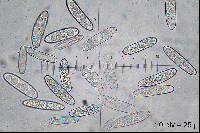 Verpa bohemica image