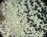 Pyxine berteriana image