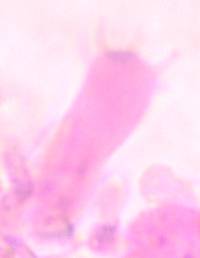 Botryobasidium subcoronatum image