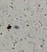 Lepista sordida image