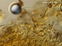 Media resource of Geastrum setiferum