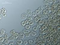 Illosporiopsis christiansenii image