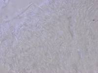 Lachnum apalum image