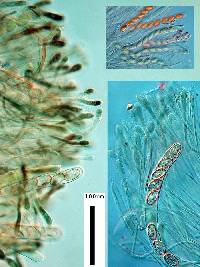 Scutellinia kerguelensis image