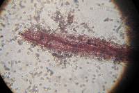 Hypochnella violacea image