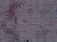 Hypochnella violacea image