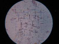 Hypochnella violacea image