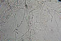 Hypochnella violacea image