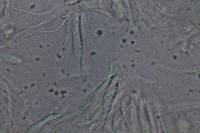 Rhytisma punctatum image