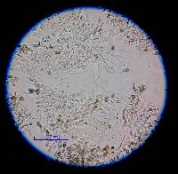 Coprinellus disseminatus image