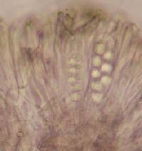 Amandinea endachroa image