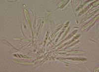 Arachnopeziza boudierii image