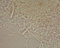 Arachnopeziza boudierii image