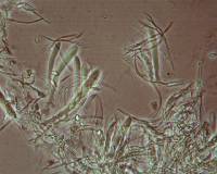 Arachnopeziza boudierii image