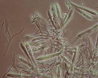 Arachnopeziza boudierii image