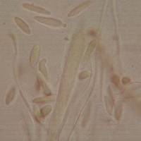 Arachnopeziza boudierii image