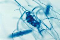 Media resource of Arthroderma grubyi