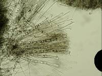 Pseudoplectania melaena image