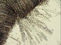 Pseudoplectania melaena image